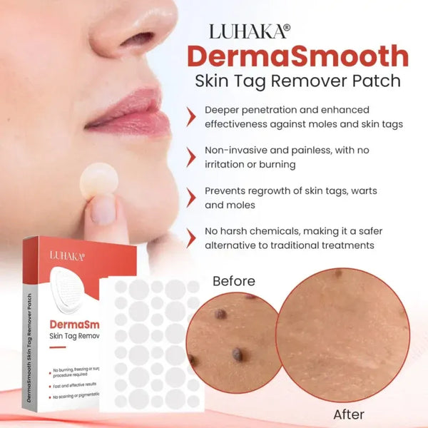 Derma Smooth Skin Tag Removal Patches