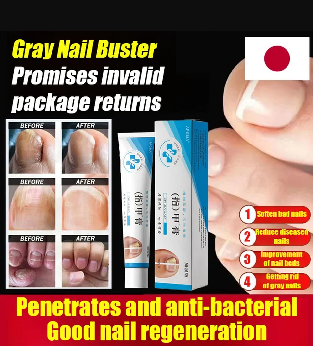 Fungal Nail Treatment Cream