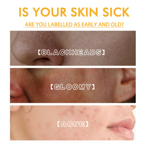 Whitening and Spot Reducing Rejuvenating Honey Tear-Off Mask