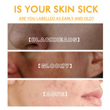 Whitening and Spot Reducing Rejuvenating Honey Tear-Off Mask