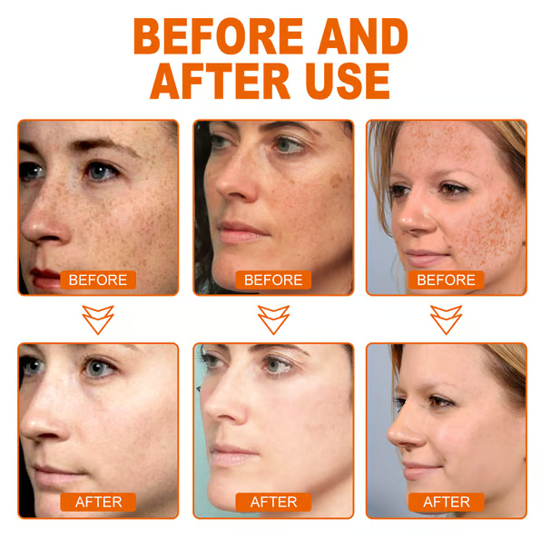 Whitening and Spot Reducing Rejuvenating Honey Tear-Off Mask