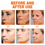 Whitening and Spot Reducing Rejuvenating Honey Tear-Off Mask